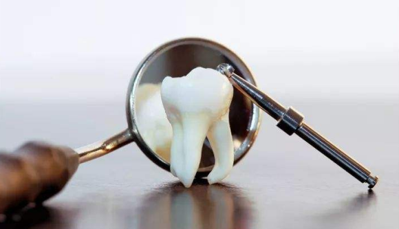 在廊坊，种牙好还是镶牙好？二者有什么区别？