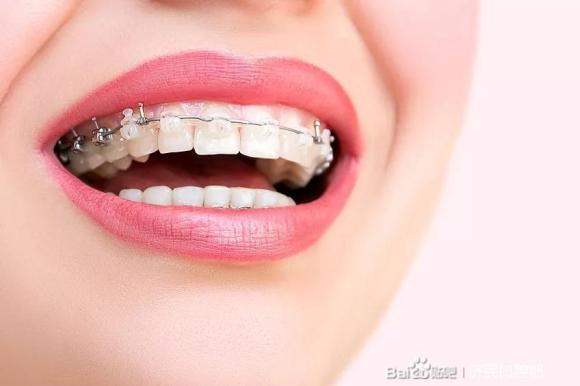在廊坊，牙齿矫正选不对医院的后果太可怕了