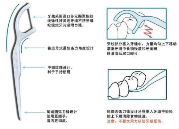 在廊坊，小孩也需要使用牙线吗？