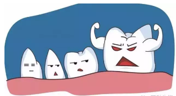 在廊坊，为什么拔智齿还要拍片？