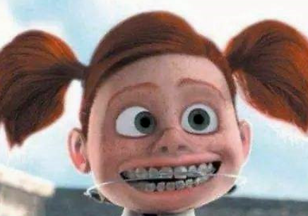 在廊坊，龅牙会遗传，是真的吗？