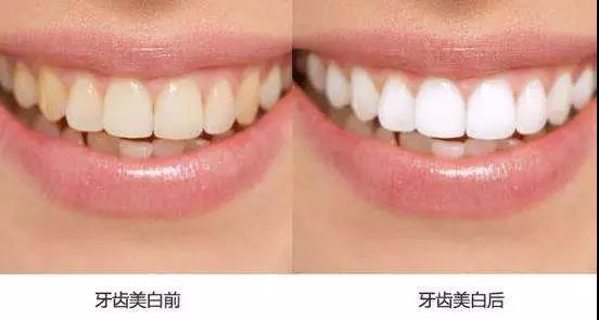 在廊坊，冷光美白到底靠不靠谱，能不能做