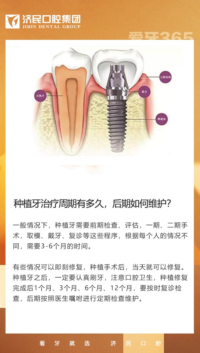 种植牙治疗周期有多久，后期如何维护？