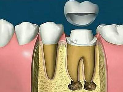 为什么我的牙白天不痛，夜晚痛？