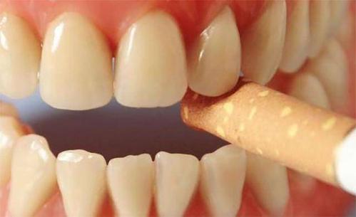 黄牙是硬伤，再美的口红色号都救不了你！